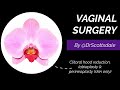 VAGINAL REJUVENATION by @DrScottsdale - Cosmetic Surgery including labiaplasty and perineoplasty