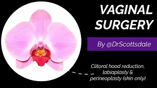 VAGINAL REJUVENATION by @DrScottsdale - Cosmetic Surgery including labiaplasty and perineoplasty