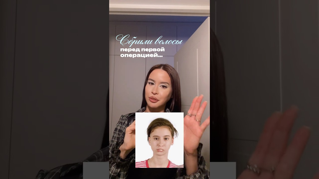 А вы бы согласились сбрить волосы ради будущей красоты?