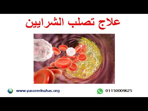 علاج تصلب الشرايين - ادوية علاج تصلب الشرايين - الجراحات المتاحة لمرض تصلب شرايين الجسم