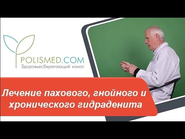 Лечение пахового, гнойного и хронического гидраденита