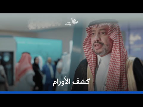 عربة الكشف عن الأورام في ملتقى الصحة العالمي 2025