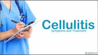 Cellulitis ¦ Treatment and Symptoms