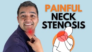 What Actually Causes Painful Neck Cervical Stenosis?