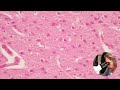 Histology of the brain