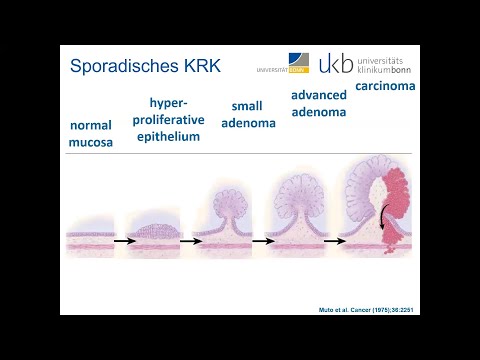 Lynch Syndrom/HNPCC & gastroenterologische Vorsorge