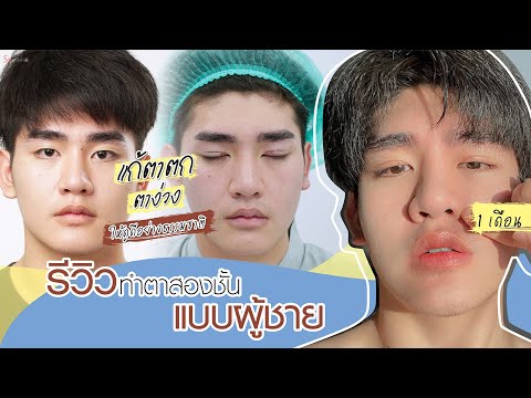 Vlog รีวิวทำตาสองชั้นผู้ชายฉบับหนุ่มตี๋ให้เป็นเกาหลีสไตล์ ที่ someko