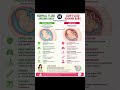 NORMAL FLUID AROUND BABY VS LOW FLUID ⚡⚕️🏥🩺 #healthtips #pregnancy #birthtips #babylove #mommytips