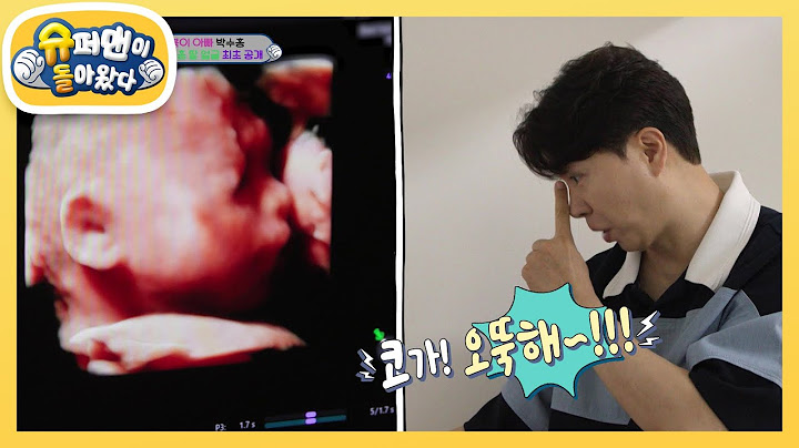 ★최초 공개★ 28주 된 전복이 초음파 공개! 수홍 아빠와 똑 닮았네!  [슈퍼맨이 돌아왔다/The Return of Superman] | KBS 240818 방송