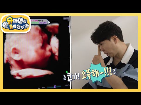 ★최초 공개★ 28주 된 전복이 초음파 공개! 수홍 아빠와 똑 닮았네!  [슈퍼맨이 돌아왔다/The Return of Superman] | KBS 240818 방송