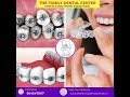 Teeth alignment @ the family dental center aligarh