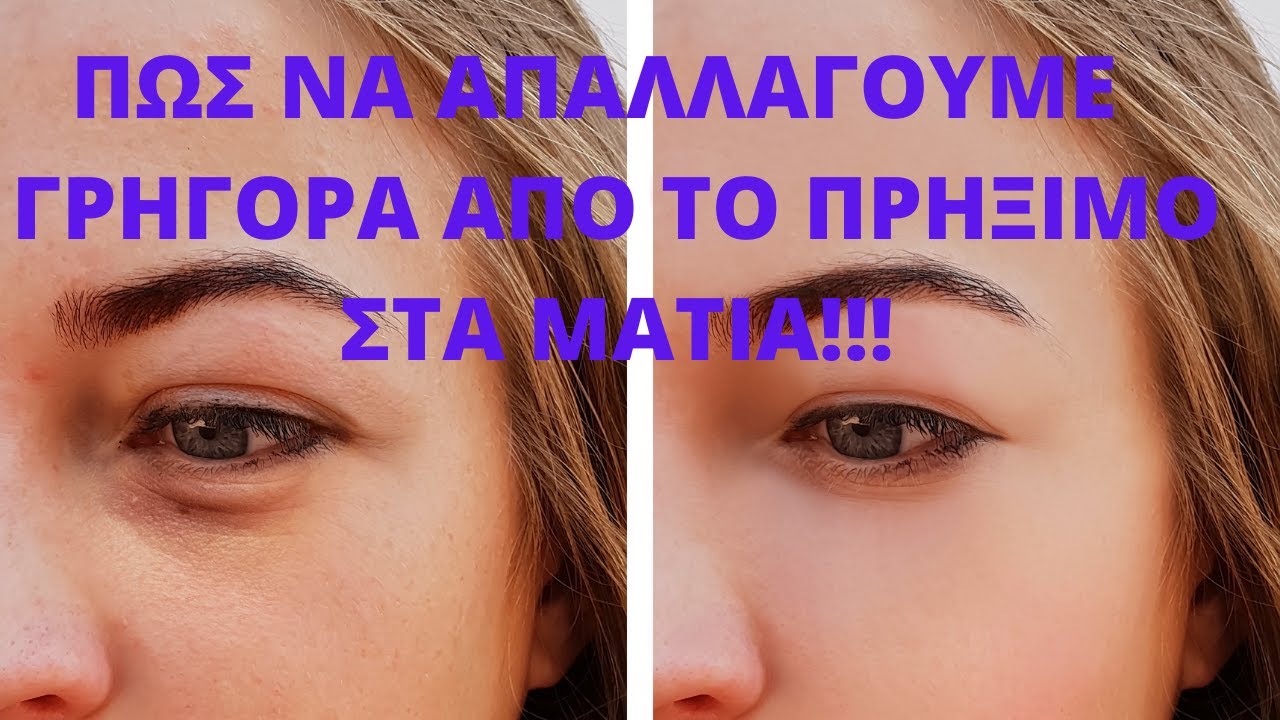 αλοιφη