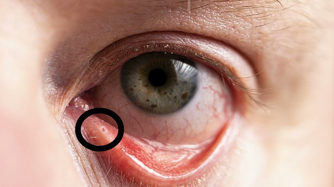 Optical Course Part 1Sclera conjunctiva punctum cornea iris