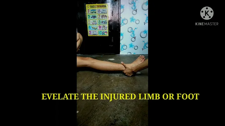 How to first aid the sprain by Jay Vincent Cepeda