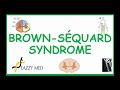 Brown-Sequard Syndrome causes, pathophysiology, symptoms diagnosis and treatment