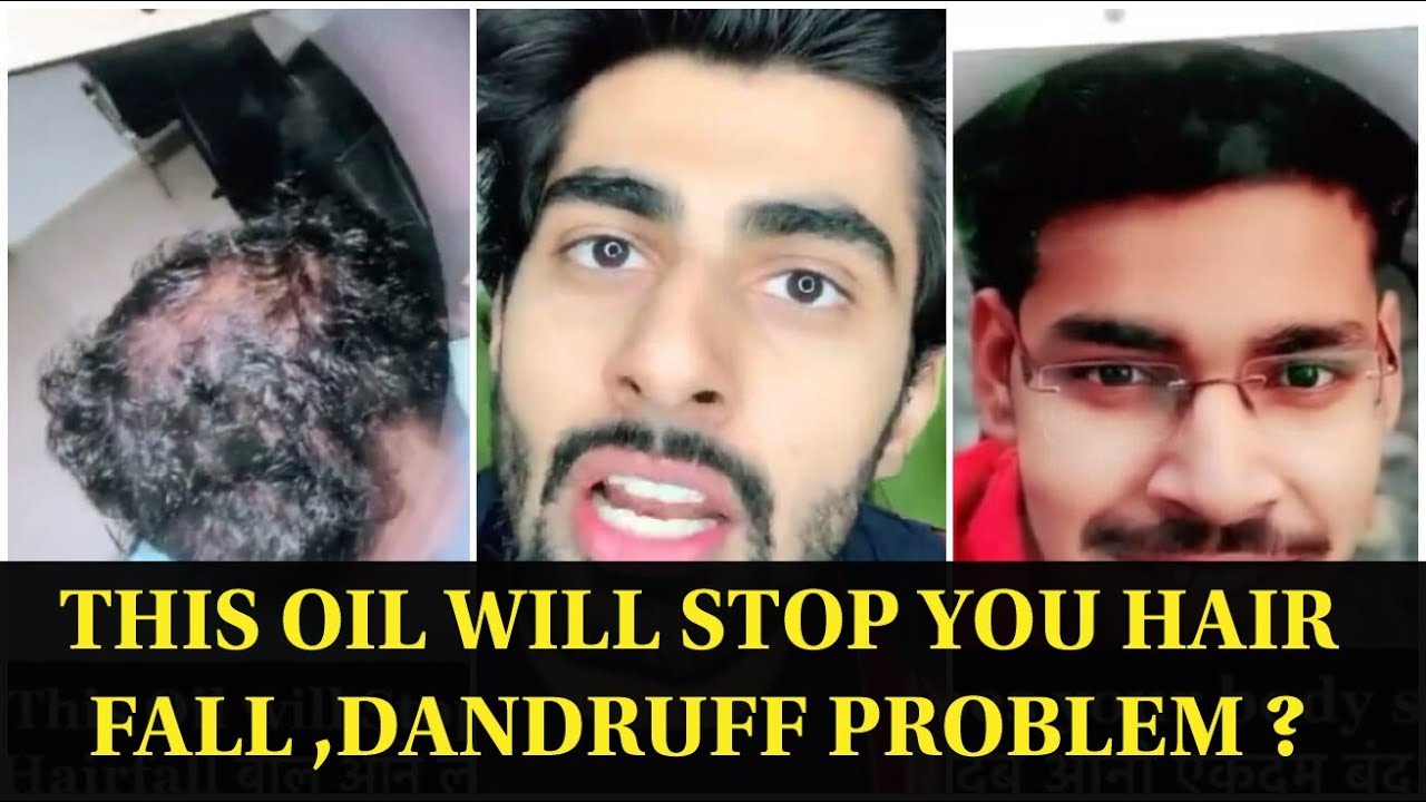 Mridul Madhok This Oil will stop Your Hair Fall , Dandruff Problem ? -  YouTube