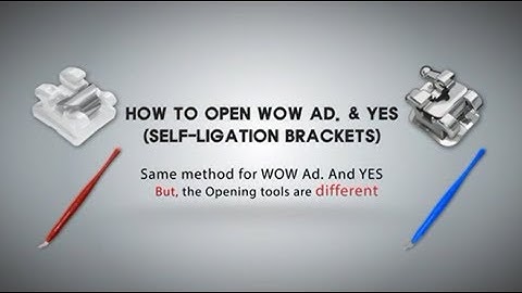 How to Properly Open and Close HUBIT Self ligation brackets