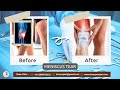 Function after meniscus tear surgery  dr amyn rajani  oaks clinic