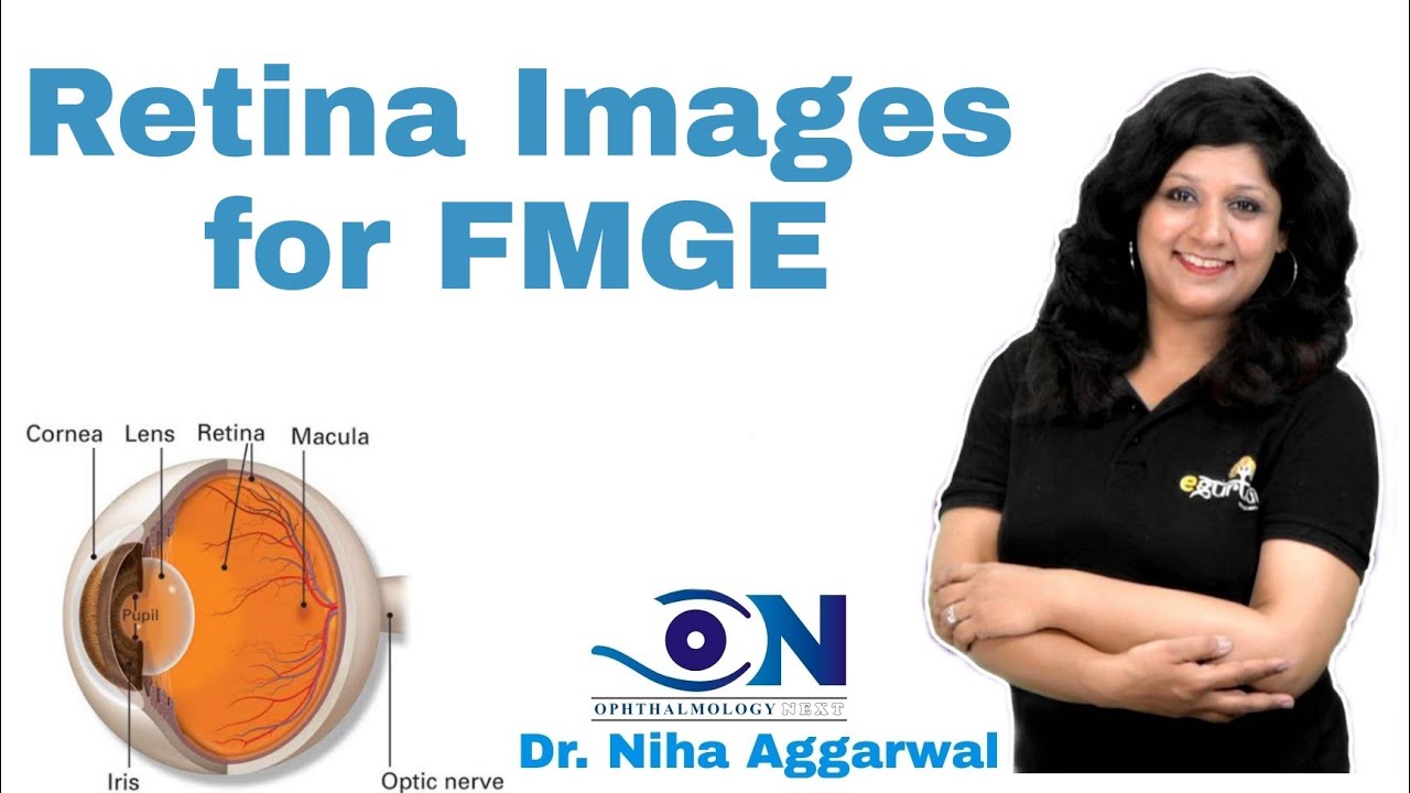 Retina Images for FMGE || Dr. Niha Aggarwal
