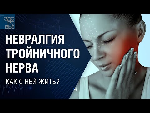 Невралгия тройничного нерва. Как с ней жить? На здоровье 20.05.2022