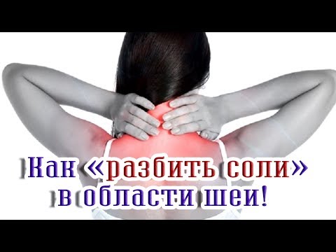 ➤Здоровье➤Как «разбить соли» в области шеи!➤