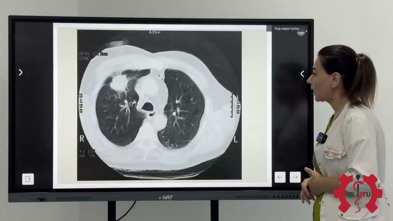 O'pka kasaliklarining nur tashxisi Shukurova S | 3-4 kurs Davolash ishi va Stomatologiya