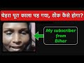 चेहरा पूरा काला पड़ गया, ठीक कैसे होगा ? My subscriber from Bihar