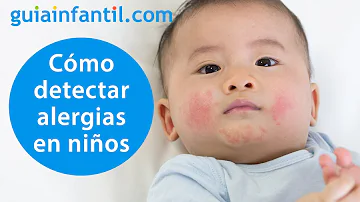 ¿Qué aspecto tiene una erupción alérgica en un niño?