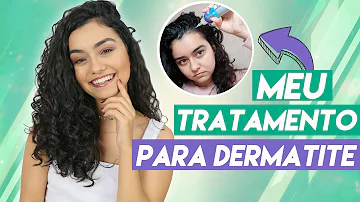 O que é bom para dermatite no couro cabeludo?