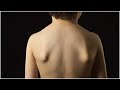 Best exercise to correct Scapular wings| Posture correction (In HINDI)