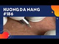 #186 | Huong Da Nang