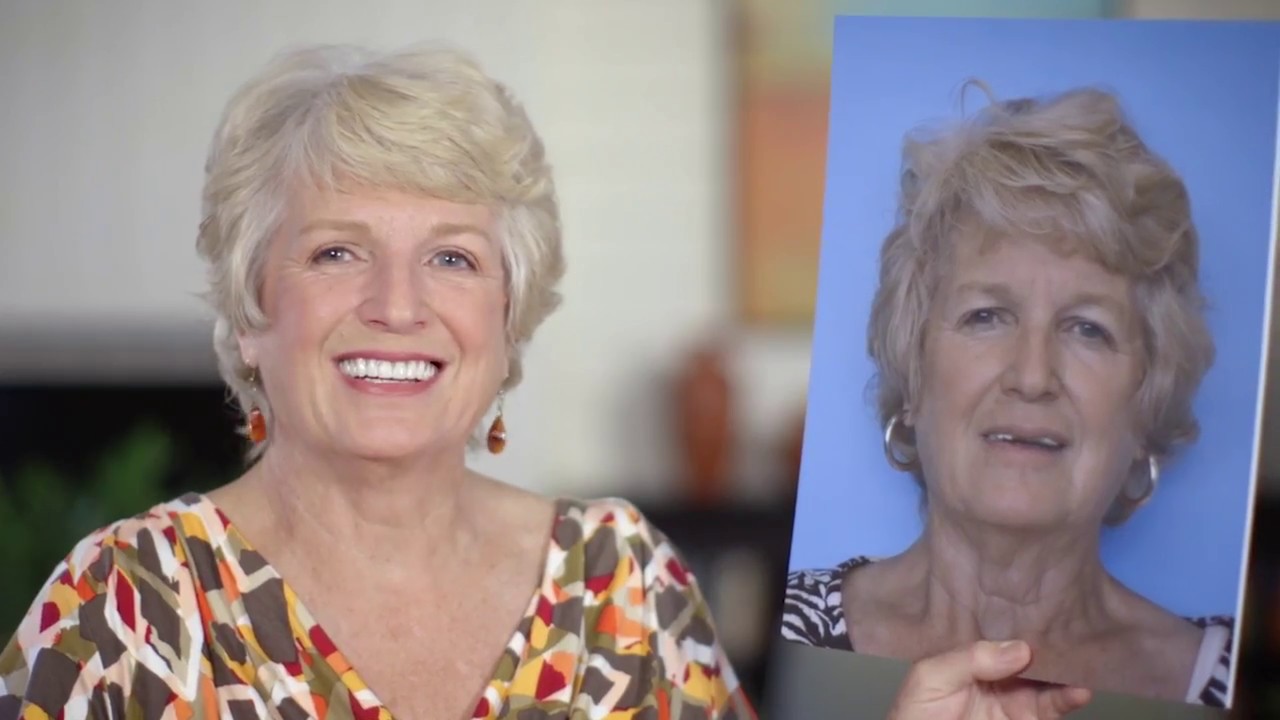 Florida Dental Implants - Full mouth restoration in one day with New Teeth Now