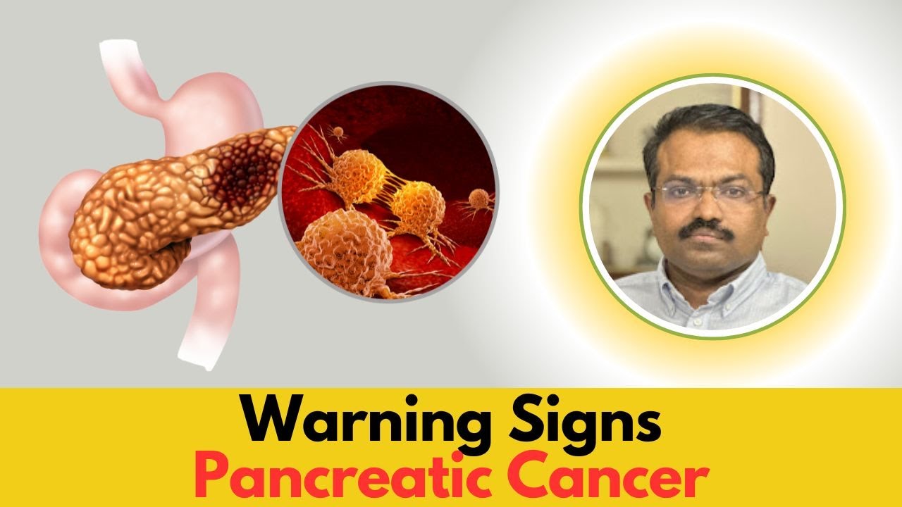 Warning Signs of Pancreatic Cancer | Signs and Symptoms of Pancreatic ...