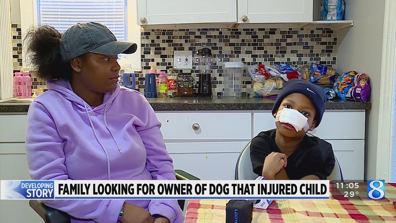 'Come forward': Boy attacked by dog hopes for answers - YouTube