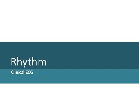 5.1-Clinical ECG 2 (Rhythm) sa node rate