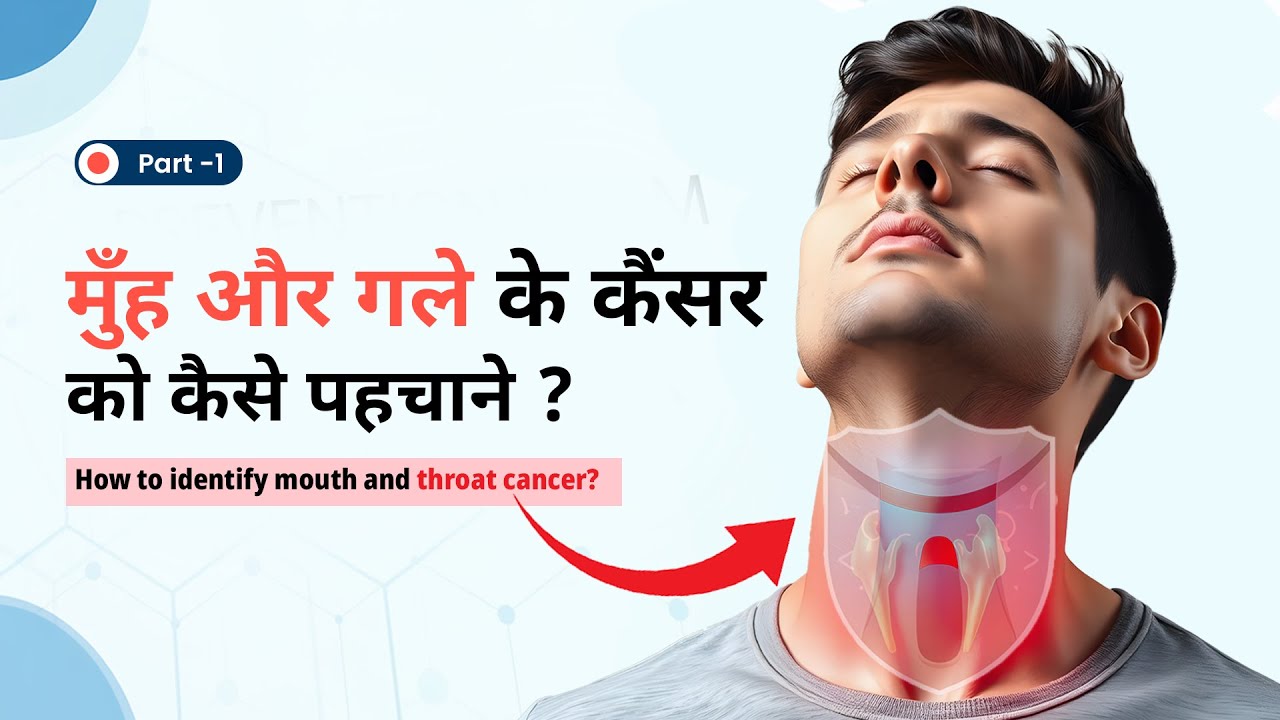 मुँह और गले का कैंसर-कारण, लक्षण, और उपाय | Mouth & Throat Cancer | Dr. Deepak Sharma