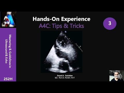 Hands-On Experience 3- A4C: Tips x Tricks