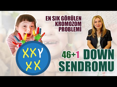 Video: Mayoz bölünme sırasında Down sendromu nasıl oluşur?