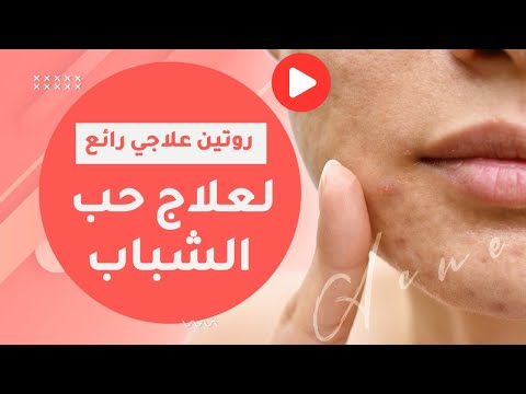 روتين علاجي رائع لعلاج حب الشباب