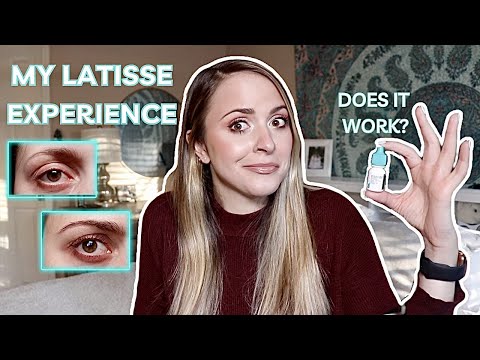 MY EXPERIENCE WITH LATISSE AND 4 MONTH RESULTS | Mistakes to avoid & Is it worth the hype and money?