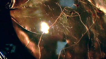 corneal neovascularization, blood flow