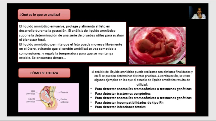 PRUEBAS BIOQUMICAS DE LQUIDO AMNITICO