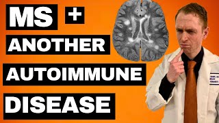 MS + Another Autoimmune Disease:  Treatment Options by Dr. Brandon Beaber 3,119 views 3 months ago 12 minutes, 28 seconds