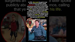 3% Survival Chance: Alex Lewis' Miraculous Story 😍 #inspiration #fyp #shorts