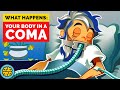 What Happens To Your Body When You&#39;re In A Coma