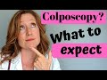 Colposcopy- What to expect when preparing for a colposcopy