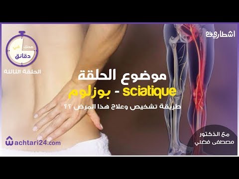 الحلقة الثالثة : عرق النساء بوزلوم - التشخيص والعلاج ؟