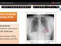 CVS Anatomy: lecture 2