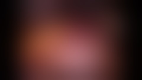 Robotic Management of Pulmonary Sequestration