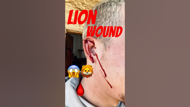 Which animal can even beat a lion in a fight?!😳